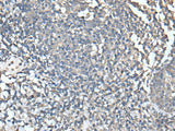 Immunohistochemistry of paraffin-embedded Human tonsil tissue using UBASH3A Polyclonal Antibody at dilution of 1:50(×200)