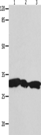 Anti-Human/Mouse/Rat YWHAG Antibody - ABMIUM