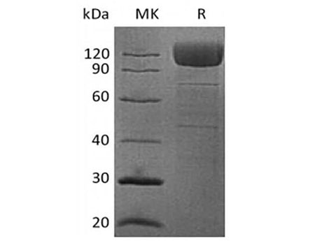 Recombinant Human platelet membrane glycoprotein IV/CD36/SR-B3 Fc Chimera Protein(Fc Tag) - ABMIUM