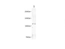 Anti-Human CD34 Antibody [581] - ABMIUM