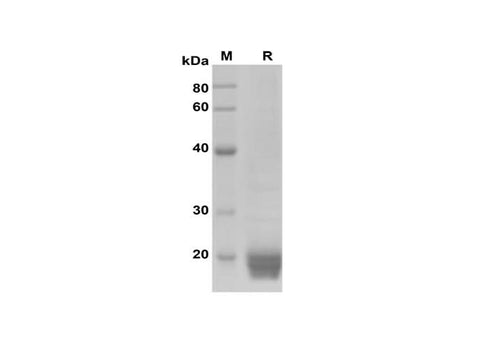 SDS-PAGE analysis of Rat IL-6 proteins, 2 μg/lane of Recombinant Rat IL-6 proteins was resolved with SDS-PAGE under reducing conditions, showing bands at 18-20 kDa.