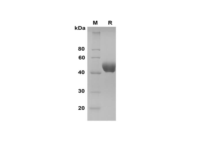 SDS-PAGE analysis of Rat Serpin E1/PAI-1 proteins, 2 μg/lane of Recombinant Rat Serpin E1/PAI-1 proteins was resolved with SDS-PAGE under reducing conditions, showing bands at 40-50 kDa.
