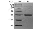 Recombinant Human APCS/SAP Protein (His Tag) - ABMIUM