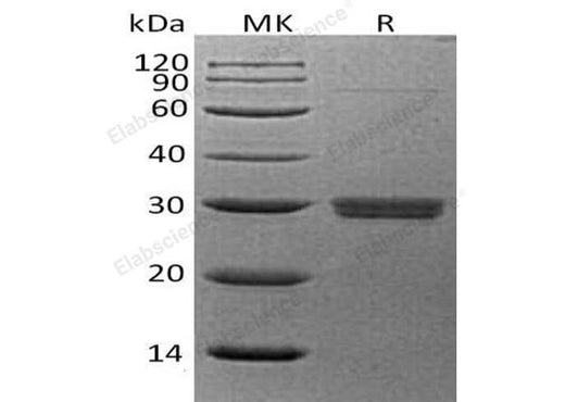 Recombinant Human APCS/SAP Protein (His Tag) - ABMIUM