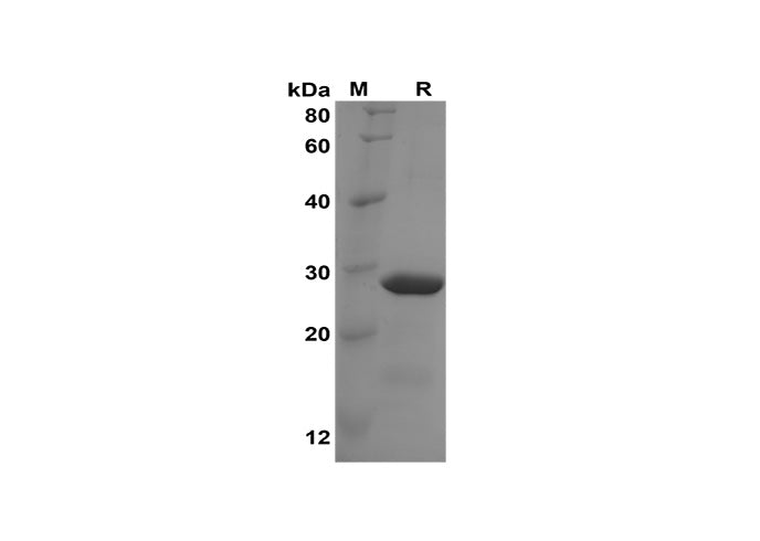 SDS-PAGE analysis of Human NUCB2 proteins, 2 μg/lane of Recombinant Human NUCB2 proteins was resolved with SDS-PAGE under reducing conditions, showing bands at 29 kDa.