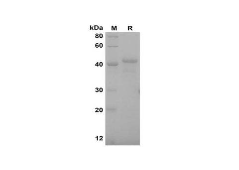 SDS-PAGE analysis of Rat M-CSF proteins, 2 μg/lane of Recombinant Rat M-CSF proteins was resolved with SDS-PAGE under reducing conditions, showing bands at 42 kDa.