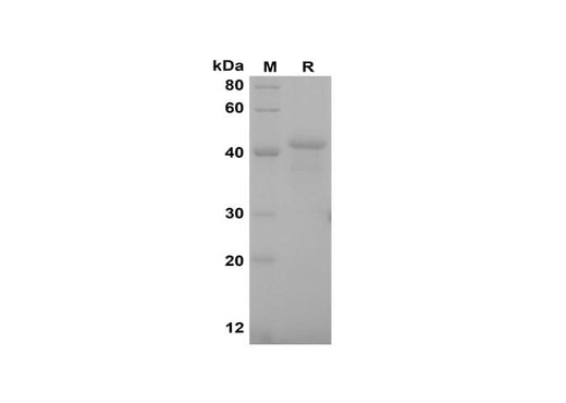 SDS-PAGE analysis of Rat M-CSF proteins, 2 μg/lane of Recombinant Rat M-CSF proteins was resolved with SDS-PAGE under reducing conditions, showing bands at 42 kDa.