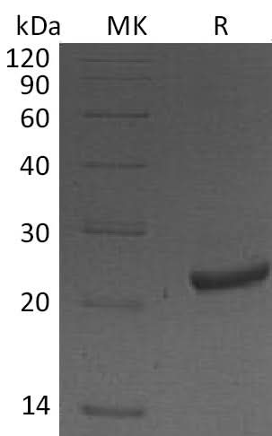 Recombinant Mouse NGAL/Lipocalin-2 Protein (His Tag) - ABMIUM
