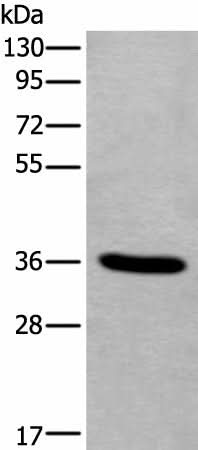 Western blot analysis of Human fetal liver tissue lysate using TNMD Polyclonal Antibody at dilution of 1:400