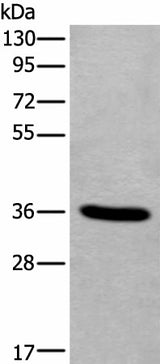 Western blot analysis of Human fetal liver tissue lysate using TNMD Polyclonal Antibody at dilution of 1:400