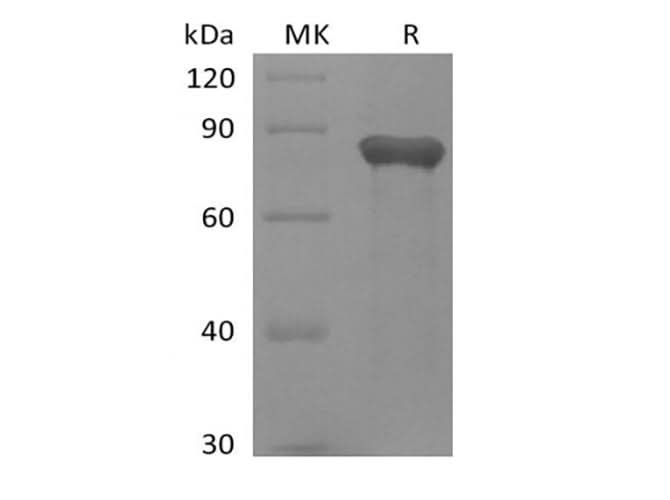 Recombinant Human GAS6 (C-6His) - ABMIUM