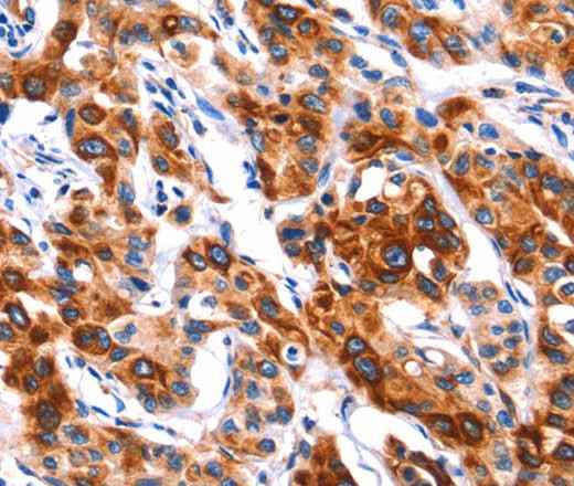 Anti-Human SEPT4 Antibody