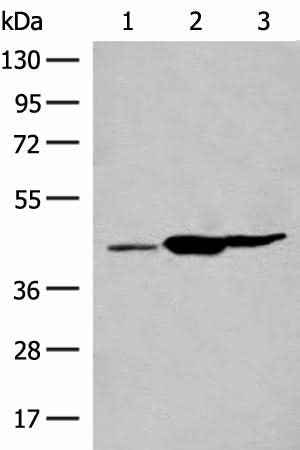 Anti-Human/Mouse GPR22 Antibody