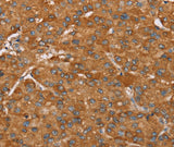 Anti-Human PAGE5 Antibody - ABMIUM