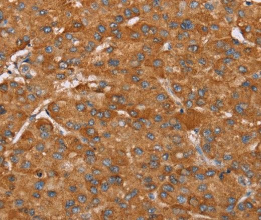 Anti-Human PAGE5 Antibody - ABMIUM