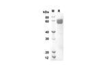 SDS-PAGE analysis of Mouse Cd200 proteins, 2 μg/lane of Recombinant Mouse Cd200 proteins was resolved with an SDS-PAGE under reducing conditions, showing bands at 47.1 kDa.