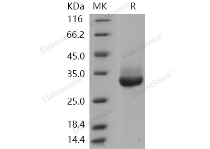 > 94 % as determined by reducing SDS-PAGE.
