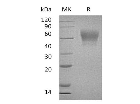 Recombinant Human TPBG/5T4 Protein (His Tag) - ABMIUM