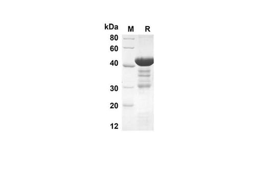 SDS-PAGE analysis of Rat GAL1 proteins, 2 μg/lane of Recombinant Rat GAL1 proteins was resolved with an SDS-PAGE under reducing conditions, showing bands at 40.7 kDa.