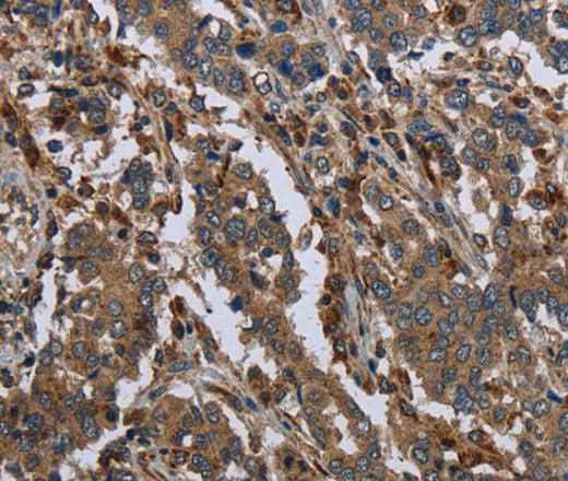 Anti-Human/Mouse/Rat GYS2 Antibody