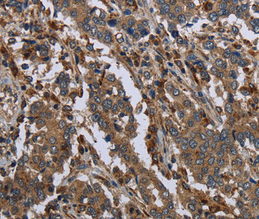 Anti-Human/Mouse/Rat GYS2 Antibody - ABMIUM