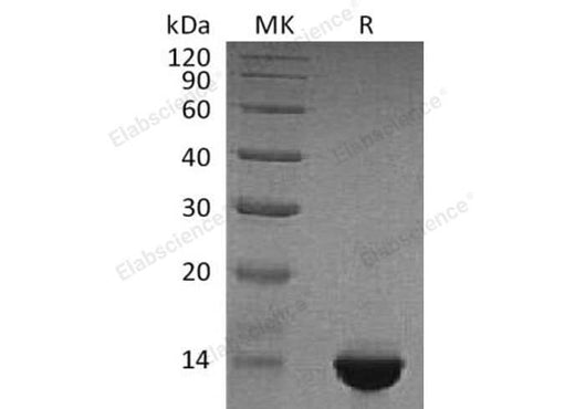 Recombinant Human Brain Natriuretic Peptide/BNP Protein (His & Flag Tag) - ABMIUM