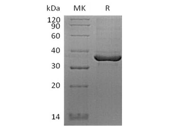 Recombinant Human FGL1 (C-Avi-6His) Biotinylated - ABMIUM