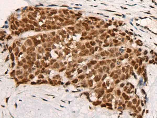 Anti-Human HGH1 Antibody
