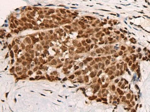 Anti-Human HGH1 Antibody - ABMIUM