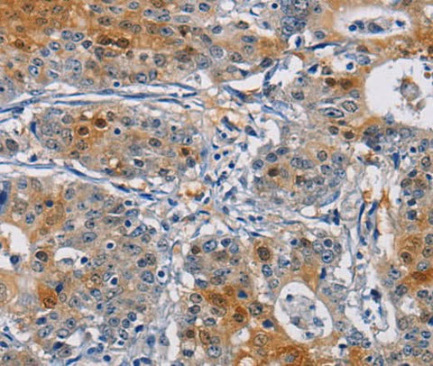 Anti-Human GSTA2 Antibody - ABMIUM