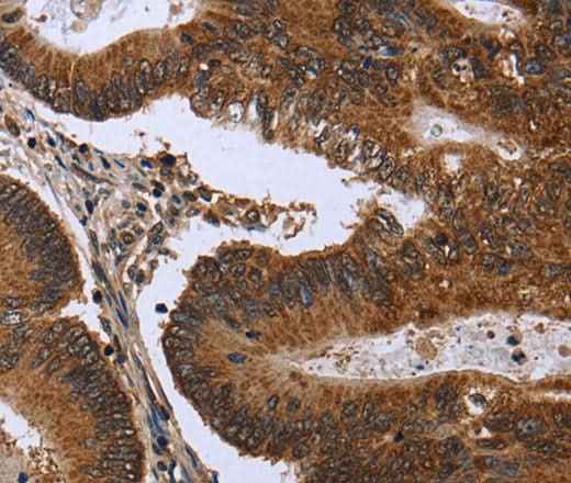 Anti-Human FGFR1OP Antibody