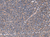 Immunohistochemistry of paraffin-embedded Human tonsil tissue using JPH2 Polyclonal Antibody at dilution of 1:40(×200)
