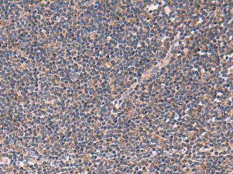 Immunohistochemistry of paraffin-embedded Human tonsil tissue using JPH2 Polyclonal Antibody at dilution of 1:40(×200)