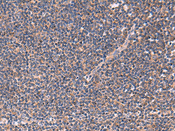 Immunohistochemistry of paraffin-embedded Human tonsil tissue using JPH2 Polyclonal Antibody at dilution of 1:40(×200)