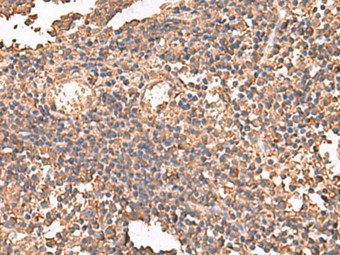 Immunohistochemistry of paraffin-embedded Human tonsil tissue using LDHAL6B Polyclonal Antibody at dilution of 1:65(×200)