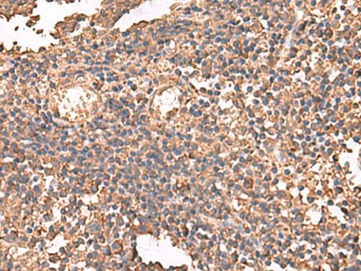 Immunohistochemistry of paraffin-embedded Human tonsil tissue using LDHAL6B Polyclonal Antibody at dilution of 1:65(×200)