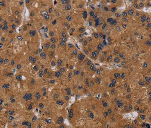 Anti-Human/Mouse NPRL2 Antibody