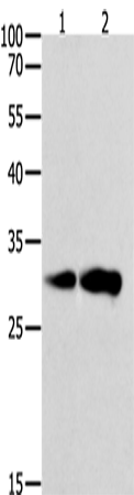 Anti-Human/Mouse/Rat CAPNS1 Antibody - ABMIUM