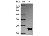 Recombinant Human CUTA Protein (His Tag) - ABMIUM