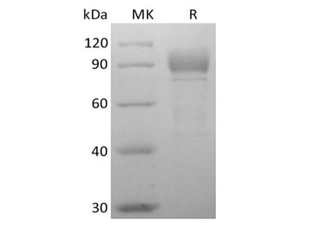 Recombinant Human Otolin-1 (C-6His) - ABMIUM