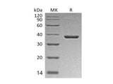 Recombinant Mouse B7-H3/CD276 Protein (His Tag) - ABMIUM