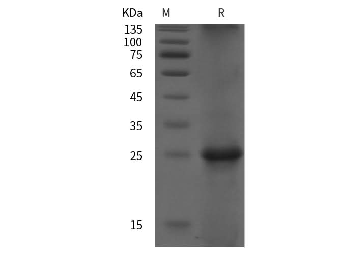 SDS-PAGE analysis of Human Rac2 proteins, 2 μg/lane of Recombinant Human Rac2 proteins was resolved with SDS-PAGE under reducing conditions, showing bands at 25 kDa.