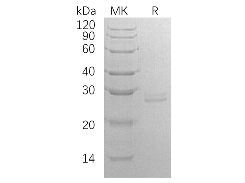 Recombinant Human RPE Protein (E.coli, His Tag) - ABMIUM