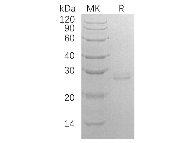 Recombinant Human RPE Protein (E.coli, His Tag) - ABMIUM