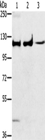 Anti-Human/Mouse/Rat ERK 5 Antibody - ABMIUM
