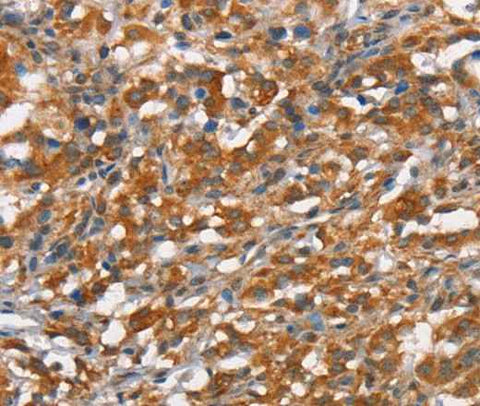 Anti-Human CD168 Antibody