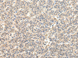 Anti-Human/Mouse/Rat VPS45 Antibody - ABMIUM