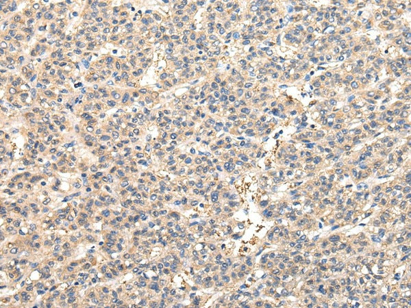 Anti-Human/Mouse/Rat VPS45 Antibody - ABMIUM