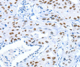 Anti-Human/Mouse ARID1A Antibody - ABMIUM