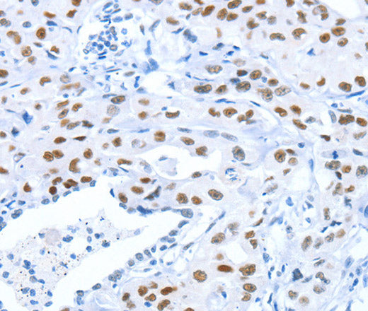 Anti-Human/Mouse ARID1A Antibody - ABMIUM